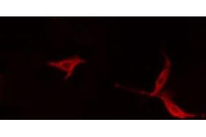 ABIN6279568 staining HepG2 cells by IF/ICC. (Myosin XVI anticorps  (Internal Region))