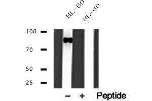 Western blot analysis of extracts of HL-60 cells, using IFT88 antibody. (IFT88 anticorps  (C-Term))