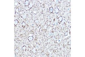 Immunohistochemistry of paraffin-embedded rat brain using G/G/G Rabbit pAb (ABIN3017018, ABIN3017019, ABIN3017020 and ABIN6219924) at dilution of 1:150 (40x lens).
