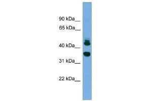 FLJ30934 antibody used at 0. (FLJ30934 (Middle Region) anticorps)