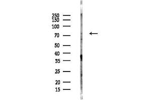 anti-Protein Kinase C, theta (PRKCQ) (C-Term) antibody