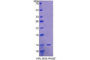 SDS-PAGE analysis of Mouse Semaphorin 3E Protein.