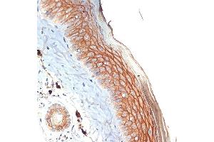 Immunohistochemistry of paraffin-embedded mouse skin using PERP Rabbit mAb (ABIN7270861) at dilution of 1:100 (40x lens). (PERP anticorps)