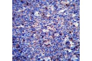 MMP3 antibody immunohistochemistry analysis in formalin fixed and paraffin embedded human tonsil tissue.