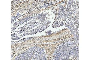IHC analysis of MT-ND5 using anti-MT-ND5 antibody (ABIN7600145). (MT-ND5 anticorps  (AA 154-570))