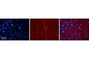 Rabbit Anti-KAT5 Antibody Catalog Number: ARP33345_P050 Formalin Fixed Paraffin Embedded Tissue: Human heart Tissue Observed Staining: Plasma membrane Primary Antibody Concentration: 1:100 Other Working Concentrations: 1:600 Secondary Antibody: Donkey anti-Rabbit-Cy3 Secondary Antibody Concentration: 1:200 Magnification: 20X Exposure Time: 0.