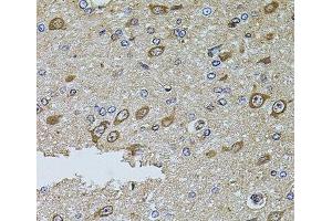 Immunohistochemistry of paraffin-embedded Rat brain using MTIF3 Polyclonal Antibody at dilution of 1:100 (40x lens).