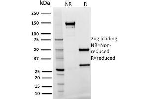 SDS-PAGE Analysis Purified SPASTIN Mouse Monoclonal Antibody (Sp 3G11-1). (Spastin anticorps)