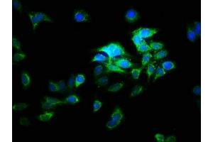 Immunofluorescence staining of HepG2 cells with ABIN7175254 at 1:166, counter-stained with DAPI.