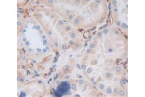 Used in DAB staining on fromalin fixed paraffin- embedded Kidney tissue (RYK anticorps  (AA 308-570))