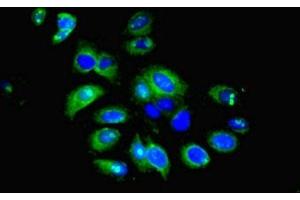 Immunofluorescent analysis of HepG2 cells using ABIN7156675 at dilution of 1:100 and Alexa Fluor 488-congugated AffiniPure Goat Anti-Rabbit IgG(H+L) (IFIT5 anticorps  (AA 107-320))