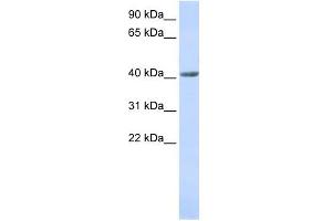 WB Suggested Anti-SMYD3 Antibody Titration:  0. (SMYD3 anticorps  (N-Term))