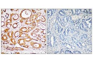 Immunohistochemistry (IHC) image for anti-Ribosomal Protein S19 (RPS19) (Internal Region) antibody (ABIN1850576) (RPS19 anticorps  (Internal Region))