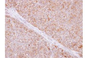 IHC-P Image Immunohistochemical analysis of paraffin-embedded DLD-1 xenograft, using TMED9, antibody at 1:500 dilution.