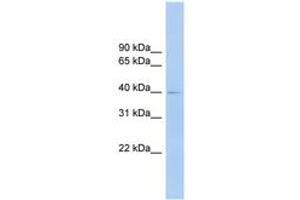 Image no. 1 for anti-Fc Receptor-Like A (FCRLA) (AA 287-336) antibody (ABIN6744875) (FCRLA anticorps  (AA 287-336))