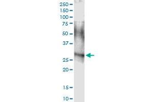 Immunoprecipitation of ARHGDIA transfected lysate using anti-ARHGDIA MaxPab rabbit polyclonal antibody and Protein A Magnetic Bead , and immunoblotted with ARHGDIA MaxPab mouse polyclonal antibody (B01) . (ARHGDIA anticorps  (AA 1-204))