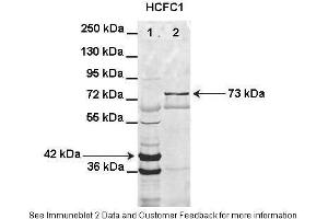 Lanes:   Lane1: HIS-HCFC1 16-363aa (42kD) transformed bacteria lysate Lane2: GFP-HCFC1 363-2002aa (73kD) transformed bacteria lysate elution sample  Primary Antibody Dilution:   1:1000  Secondary Antibody:   Anti-rabbit AlexaFluor 680  Secondary Antibody Dilution:   1:10000  Gene Name:   HCFC1  Submitted by:   Anonymous (HCFC1 anticorps  (N-Term))