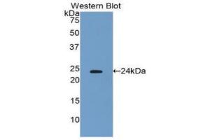 Western blot analysis of the recombinant protein. (IFNB1 anticorps  (AA 22-186))