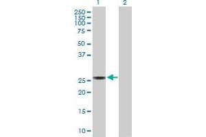 Western Blot analysis of SPR expression in transfected 293T cell line by SPR MaxPab polyclonal antibody. (SPR anticorps  (AA 1-261))