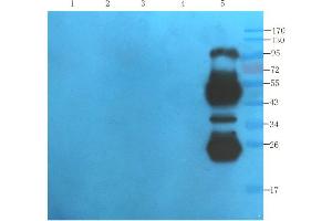 Western Blot using anti-IL2R antibody   Mouse lipocyte (lane 1), mouse spleen (lane 2), mouse thymus (lane 3), mouse lymph node (lane 4) and human thyroid tumour (lane 5) samples were resolved on a 10% SDS PAGE gel and blots probed with  at 1. (Recombinant IL2RA (Daclizumab Biosimilar) anticorps)
