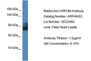 WB Suggested Anti-LRRC8A Antibody Titration:  0. (LRRC8A anticorps  (Middle Region))