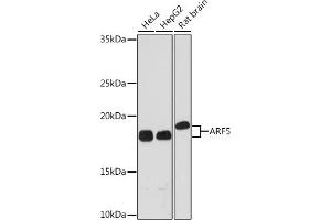 Western blot analysis of extracts of various cell lines, using  Rabbit mAb (ABIN7265484) at 1:1000 dilution. (ARF5 anticorps)