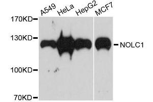 Western blot analysis of extracts of various cell lines, using NOLC1 antibody. (NOLC1 anticorps  (AA 400-699))