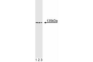 Western blot analysis of TAF[II] 135 on Jurkat lysate.