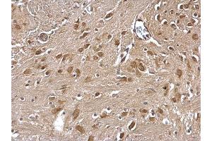 IHC-P Image GLMN antibody detects GLMN protein at cytosol on mouse fore brain by immunohistochemical analysis. (GLMN anticorps)
