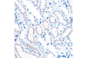 Immunohistochemistry of paraffin-embedded mouse kidney using L Rabbit mAb  at dilution of 1:100 (40x lens). (LAMP2 anticorps)