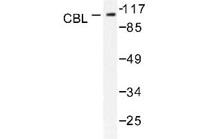 Image no. 1 for anti-Cas-Br-M (Murine) Ecotropic Retroviral Transforming Sequence (CBL) antibody (ABIN271925) (CBL anticorps)