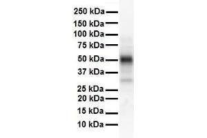 WB Suggested Anti-ESR2 antibody Titration: 1 ug/mL Sample Type: Human heart (ESR2 anticorps  (N-Term))