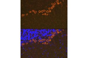 Immunofluorescence analysis of mouse brain using IP3R Rabbit mAb (ABIN1679064, ABIN3018927, ABIN3018928 and ABIN7101690) at dilution of 1:100 (40x lens).