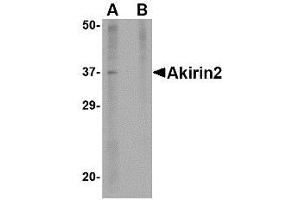 Image no. 1 for anti-Akirin 2 (AKIRIN2) (Internal Region) antibody (ABIN342720) (AKIRIN2 anticorps  (Internal Region))