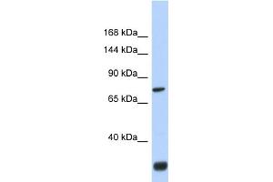 Host:  Rabbit  Target Name:  FNDC3A  Sample Type:  Fetal Brain lysates  Antibody Dilution:  1. (FNDC3A anticorps  (N-Term))