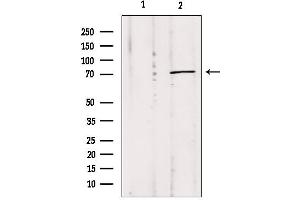 Western blot analysis of extracts from Mouse Myeloma cell, using MPP5 antibody. (MPP5 anticorps  (C-Term))