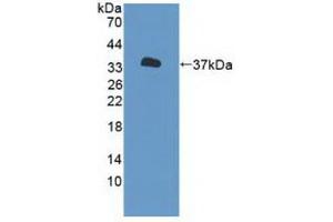 Western blot analysis of recombinant Human P2RX7. (P2RX7 anticorps  (AA 47-334))