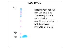 SDS-PAGE (SDS) image for Epidermal Growth Factor (EGF) (Active) protein (ABIN5509414) (EGF Protéine)