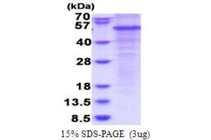 SDS-PAGE (SDS) image for Complement Factor P (CFP) (AA 28-469) protein (His tag) (ABIN5853789) (CFP Protein (AA 28-469) (His tag))