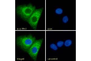 (ABIN185533) Immunofluorescence analysis of paraformaldehyde fixed A549 cells, permeabilized with 0.