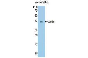 Western blot analysis of the recombinant protein.