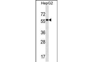 Western blot analysis in HepG2 cell line lysates (35ug/lane). (ALDH3B2 anticorps  (C-Term))