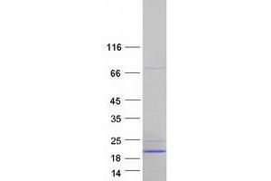 Validation with Western Blot