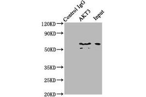 Immunoprecipitating AKT3 in mouse brain whole cell lysate Lane 1: Rabbit control IgG (1 μg) instead of ABIN7167032 in mouse brain whole cell lysate.