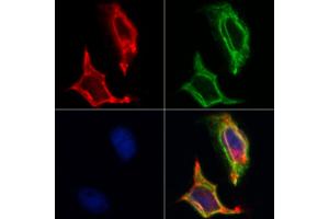 ABIN6262608 and ABIN6268730 staining Hela by IF/ICC. (ITGA3 anticorps)