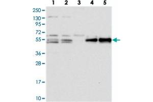 Western blot analysis of Lane 1: RT-4, Lane 2: U-251 MG, Lane 3: Human Plasma, Lane 4: Liver, Lane 5: Tonsil with PRRC1 polyclonal antibody . (PRRC1 anticorps)