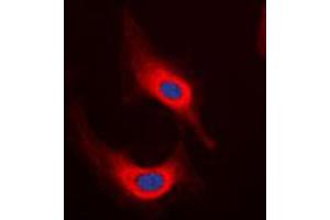 Immunofluorescent analysis of Desmin staining in HeLa cells. (Desmin anticorps  (C-Term))