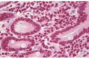 Image no. 2 for anti-Cyclin D1 (CCND1) (AA 250-300) antibody (ABIN1491282)