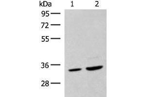 Western blot analysis of Hela cell and Human fetal liver tissue lysates using SCGN Polyclonal Antibody at dilution of 1:600