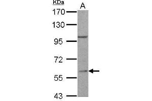 WB Image RGS14 antibody [C3], C-term detects RGS14 protein by Western blot analysis. (RGS14 anticorps  (C-Term))